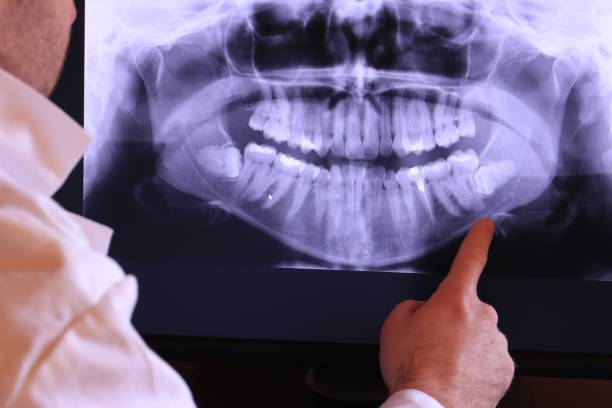 Best Emergency Treatment for Dental Infections or Abscesses in Pepperdine University, CA